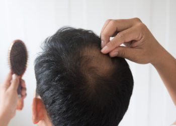 Trattamento PRP: tutto quello che devi sapere