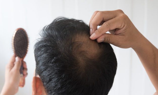 Trattamento PRP: tutto quello che devi sapere