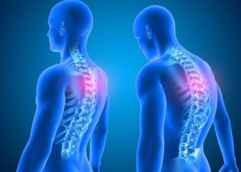 Come riottenere la giusta postura