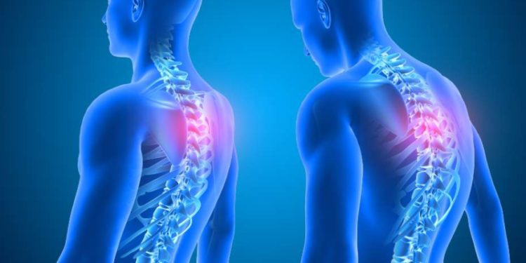 Come riottenere la giusta postura