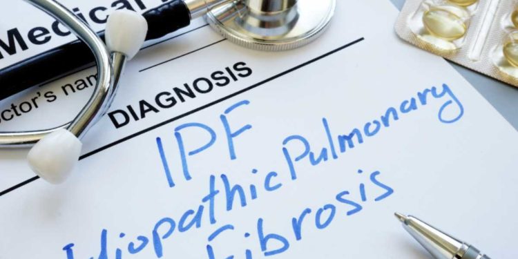 Fibrosi idiopatica polmonare: consulti gratuiti e camminate sociali