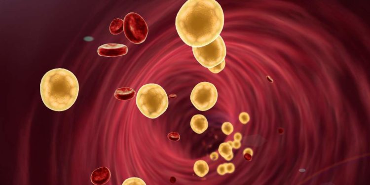 Global Heart Hub annuncia il lancio di una nuova ricerca condotta dai pazienti per centrare l’attenzione sui livelli di colesterolo non sani