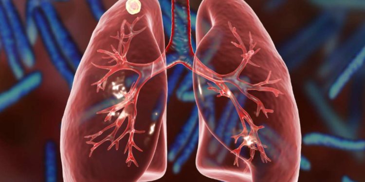 Adolescenti e infezioni respiratorie: lo studio