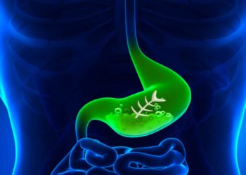 Bruciore di stomaco, ecco quando preoccuparsi