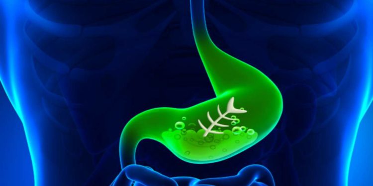 Bruciore di stomaco, ecco quando preoccuparsi