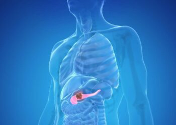 Un farmaco anti-asmatico con potenziali effetti per il trattamento del tumore al pancreas