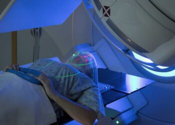 Radioterapia: sempre più precisa e personalizzata per ridurre effetti collaterali