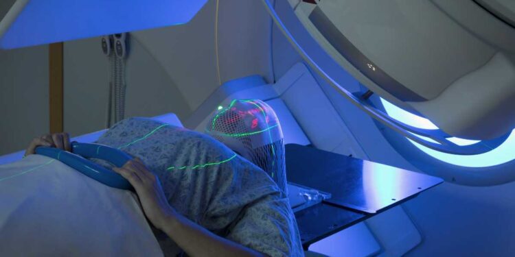 Radioterapia: sempre più precisa e personalizzata per ridurre effetti collaterali
