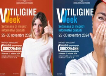 La ‘Vitiligine Week’ arriva in Liguria: incontri gratuiti con i dermatologi