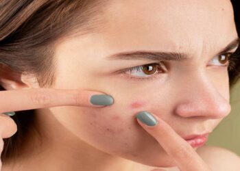 Pelle sensibile: una sfida quotidiana tra prevenzione e trattamento