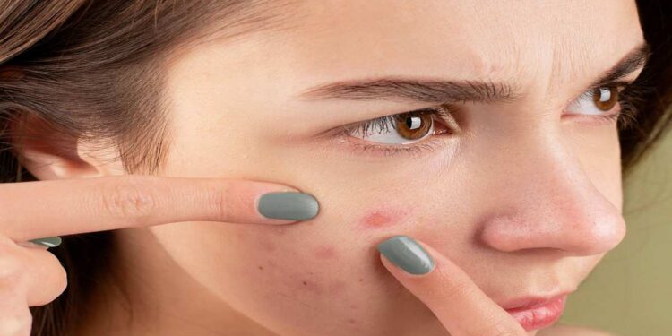 Pelle sensibile: una sfida quotidiana tra prevenzione e trattamento