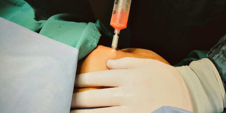 Chirurgia estetica o trovata pubblicitaria? Bob Sinclar svela la verità sui ritocchini al viso