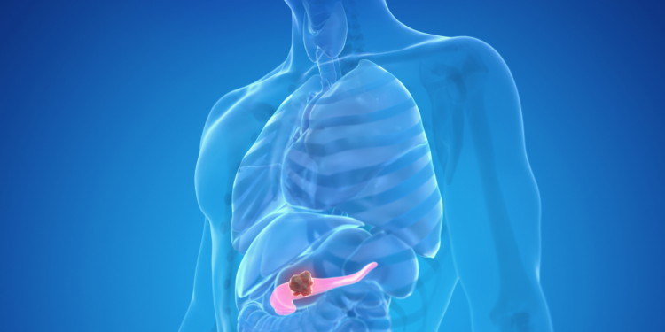 Eleonora Giorgi, parla l’oncologo che ha curato l’attrice: “Il tumore al pancreas è in aumento”