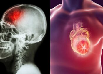 Ictus e infarto nella donna, a Milano focus su sintomi e strategie