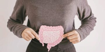 Colon-retto: aumentano i pazienti under 50 anni