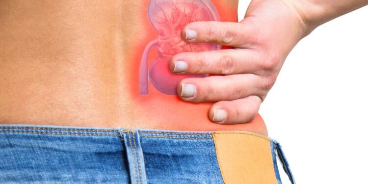 Curare il rene: diagnosi precoce con AI e biopsia liquida