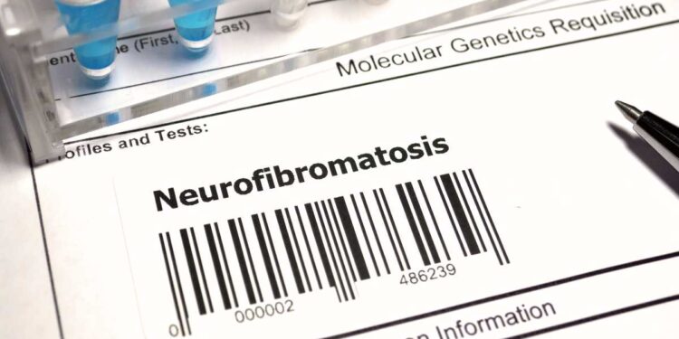 Neurofibromatosi e rischio oncologico