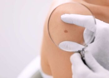 Una sonda per scoprire i danni della pelle