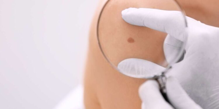 Una sonda per scoprire i danni della pelle