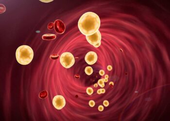 1 paziente su 3 con colesterolo alto e un evento cardiovascolare pregresso è “lost in treatment”