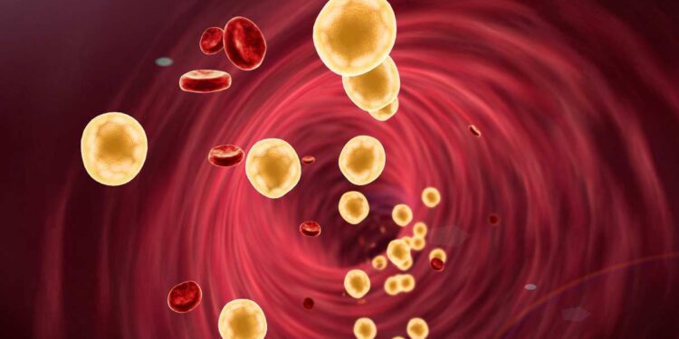 1 paziente su 3 con colesterolo alto e un evento cardiovascolare pregresso è “lost in treatment”